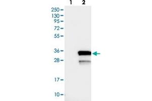 Western blot analysis of Lane 1: Negative control (vector only transfected HEK293T lysate), Lane 2: Over-expression Lysate (Co-expressed with a C-terminal myc-DDK tag (~3. (LYSMD1 anticorps)