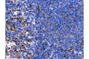 IHC analysis of Hsp47/SERPINH1 using anti-Hsp47/SERPINH1 antibody (ABIN3043331). (SERPINH1 anticorps  (AA 247-418))