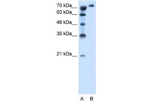 SLC6A18 antibody used at 1. (SLC6A18 anticorps  (Middle Region))