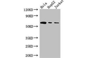 Western Blot Positive WB detected in: Hela whole cell lysate, HepG2 whole cell lysate, Jurkat whole cell lysate All lanes: HPSE antibody at 3 μg/mL Secondary Goat polyclonal to rabbit IgG at 1/50000 dilution Predicted band size: 62, 55, 54, 43 kDa Observed band size: 62 kDa (HPSE anticorps  (AA 263-523))