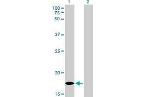Western Blotting (WB) image for anti-Multiple Coagulation Factor Deficiency 2 (MCFD2) (AA 1-147) antibody (ABIN599316) (MCFD2 anticorps  (AA 1-147))