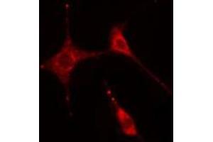 ABIN6269331 staining  HeLa cells by IF/ICC.