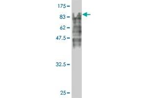 Western Blot detection against Immunogen (96. (ECD/SGT1 anticorps  (AA 1-644))