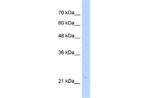 WB Suggested Anti-NUDT16L1 Antibody Titration: 5.
