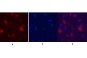 Immunofluorescence analysis of rat brain tissue. (Ubiquitin anticorps)