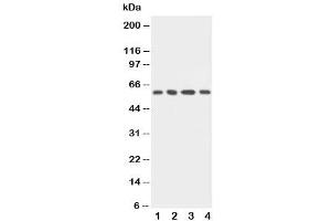 Western blot testing of uPAR antibody and Lane 1:  MCF-7 (uPAR uPA Receptor (C-Term) anticorps)