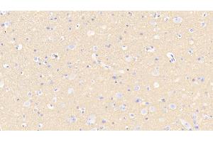 Detection of SNAP25 in Human Cerebellum Tissue using Polyclonal Antibody to Synaptosomal Associated Protein 25 kDa (SNAP25) (SNAP25 anticorps  (AA 1-206))