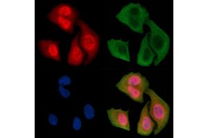 ABIN6256440 and ABIN6267350 staining Hela cells(30 min of UV treatment) by IF/ICC. (Bcl-2 anticorps  (pSer87))