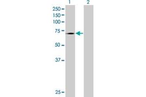Lane 1: TLR4 transfected lysate ( 70. (TLR4 293T Cell Transient Overexpression Lysate(Denatured))