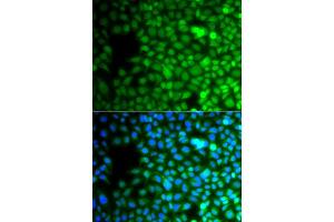 Immunofluorescence analysis of A549 cell using ZNF195 antibody. (ZNF195 anticorps)