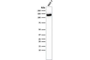 Western Blot Analysis of MCF-7 cells using E-Cadherin Rabbit Recombinant Monoclonal Antibody (CDH1/2208R).