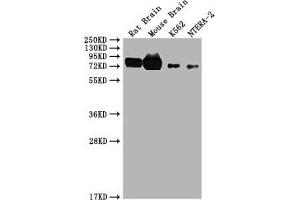 Western Blot Positive WB detected in: Rat brain tissue, Mouse brain tissue, K562, NTERA-2 All lanes: WASF1 antibody at 1.