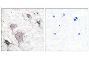 Immunohistochemistry (IHC) image for anti-Peripherin (PRPH) (C-Term) antibody (ABIN1848740) (Peripherin anticorps  (C-Term))