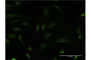 Immunofluorescence of monoclonal antibody to BCL9 on HeLa cell. (BCL9 anticorps  (AA 1036-1135))