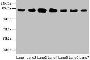 Western blot All lanes: CLGN antibody at 7 μg/mL Lane 1: Mouse brain tissue Lane 2: Mouse lung tissue Lane 3: Jurkat whole cell lysate Lane 4: HepG2 whole cell lysate Lane 5: PC-3 whole cell lysate Lane 6: Hela whole cell lysate Lane 7: HL60 whole cell lysate Secondary Goat polyclonal to rabbit IgG at 1/10000 dilution Predicted band size: 71, 47 kDa Observed band size: 80 kDa (Calmegin anticorps  (AA 200-400))