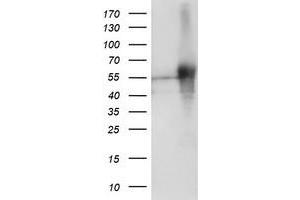 Western Blotting (WB) image for anti-SH2 Domain Protein 2A (SH2D2A) antibody (ABIN1500914) (SH2D2A anticorps)