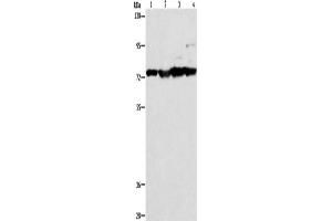 Western Blotting (WB) image for anti-Matrix Metallopeptidase 15 (Membrane-inserted) (MMP15) antibody (ABIN2421859) (MMP15 anticorps)