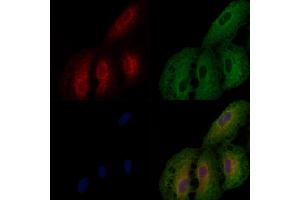 ABIN6257787 and ABIN6274815 staining  cells by IF/ICC.