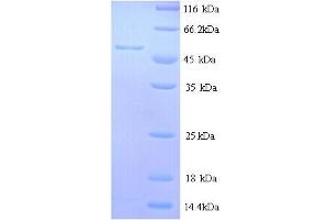 SDS-PAGE (SDS) image for Microtubule-Associated Protein 2 (MAP2) (AA 2-478) protein (His tag) (ABIN5713640)