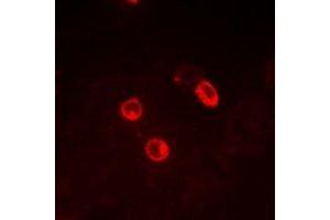 Immunofluorescent analysis of CG alpha staining in MCF7 cells. (CGA anticorps)