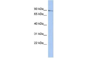 WB Suggested Anti-MLH1 Antibody Titration: 0. (MLH1 anticorps  (N-Term))