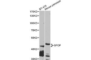 Western blot analysis of extracts of various cell lines, using SPOP antibody. (SPOP-B anticorps)