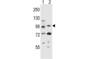 AHR antibody western blot analysis in (1) mouse NIH3T3 and (2) human T47D cell line lysate. (Aryl Hydrocarbon Receptor anticorps  (AA 555-582))