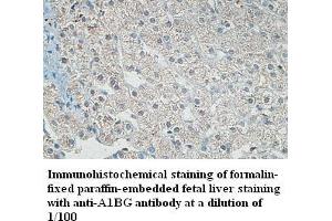 Image no. 1 for anti-alpha-1-B Glycoprotein (A1BG) antibody (ABIN791226) (A1BG anticorps)