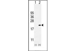 Western blot analysis of CDKN2C (arrow) using rabbit polyclonal CDKN2C Antibody (C-term) (ABIN654908 and ABIN2844555). (CDKN2C anticorps  (C-Term))
