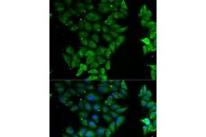 Immunofluorescence analysis of MCF7 cells using ELF3 Polyclonal Antibody