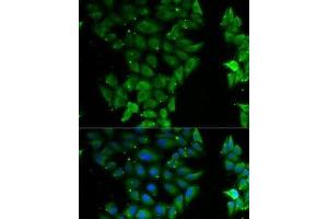 Immunofluorescence analysis of MCF7 cells using ELF3 Polyclonal Antibody (ELF3 anticorps)