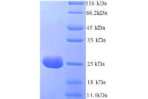 SDS-PAGE (SDS) image for Retinol Binding Protein 4, Plasma (RBP4) (AA 18-225) protein (His tag) (ABIN5714196)