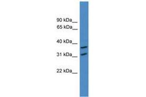 Image no. 1 for anti-OTU Domain Containing 6A (OTUD6A) (AA 51-100) antibody (ABIN6745381) (OTUD6A anticorps  (AA 51-100))