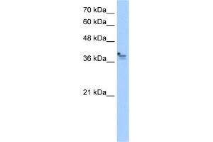 WB Suggested Anti-PCMTD1 Antibody Titration:  2. (PCMTD1 anticorps  (Middle Region))