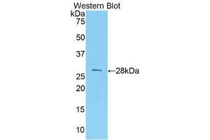 Western Blotting (WB) image for anti-Melanoma Cell Adhesion Molecule (MCAM) (AA 324-565) antibody (ABIN1859776) (MCAM anticorps  (AA 324-565))