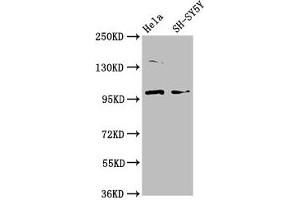 Western Blot Positive WB detected in: Hela whole cell lysate, SH-SY5Y whole cell lysate All lanes: PDE6C antibody at 3. (PDE6C anticorps  (AA 285-451))