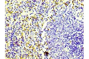 IHC image of ABIN7127275 diluted at 1:100 and staining in paraffin-embedded human spleen tissue performed on a Leica BondTM system. (Recombinant CD163 anticorps)