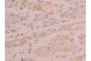 Detection of TNFSF14 in Human Stomach Tissue using Polyclonal Antibody to Tumor Necrosis Factor Ligand Superfamily, Member 14 (TNFSF14)