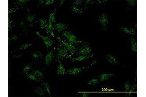 Image no. 3 for anti-Cofilin 2 (CFL2) (AA 57-167) antibody (ABIN598607) (Cofilin 2 anticorps  (AA 57-167))