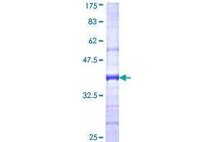 Image no. 1 for DDB1 and CUL4 Associated Factor 10 (DCAF10) (AA 1-110) protein (GST tag) (ABIN1325222)