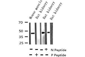 Western blot analysis of Phospho-hnRNP C1/2 (Ser260) expression in various lysates