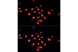Immunofluorescence analysis of C6 cells using GTF3C4 Polyclonal Antibody  at dilution of 1:100 (40x lens). (GTF3C4 anticorps  (AA 583-822))
