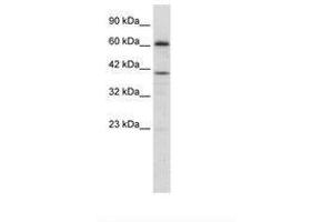 Image no. 2 for anti-PR Domain Containing 14 (PRDM14) (AA 208-257) antibody (ABIN202775) (PRDM14 anticorps  (AA 208-257))