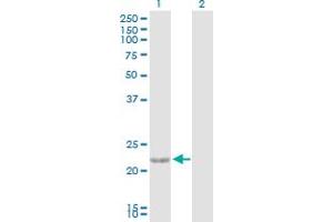 Western Blot analysis of CTF1 expression in transfected 293T cell line by CTF1 MaxPab polyclonal antibody. (Cardiotrophin 1 anticorps  (AA 1-201))