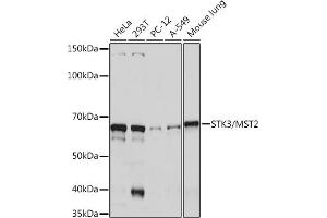 Western blot analysis of extracts of various cell lines, using STK3/MST2 Rabbit mAb (ABIN7270223) at 1:1000 dilution.