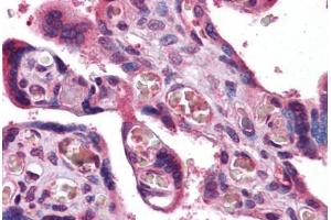 Human Placenta: Formalin-Fixed, Paraffin-Embedded (FFPE) (Transferrin Receptor anticorps  (AA 169-377))