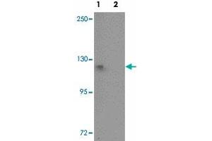 Western blot analysis of PIWIL1 in HepG2 cell lysate with PIWIL1 polyclonal antibody  at 1 ug/mL in (1) the absence and (2) the presence of blocking peptide. (PIWIL1 anticorps  (N-Term))