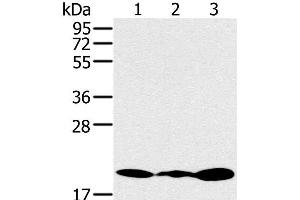 Western Blot analysis of Jurkat, 231 and K562 cell using RNF5 Polyclonal Antibody at dilution of 1:200 (RNF5 anticorps)