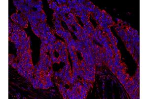Immunofluorescence (IF) image for anti-A Kinase (PRKA) Anchor Protein 1 (AKAP1) (AA 375-425) antibody (ABIN7448928) (AKAP1 anticorps  (AA 375-425))