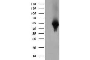 Western Blotting (WB) image for anti-Haptoglobin (HP) antibody (ABIN1498579) (Haptoglobin anticorps)